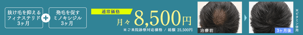 薄毛ストップ・予防3ヶ月コース