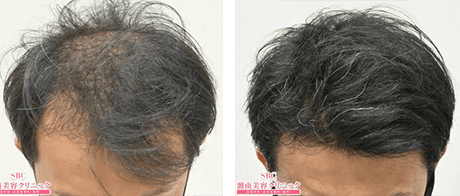 症例写真 30代 case02 before after