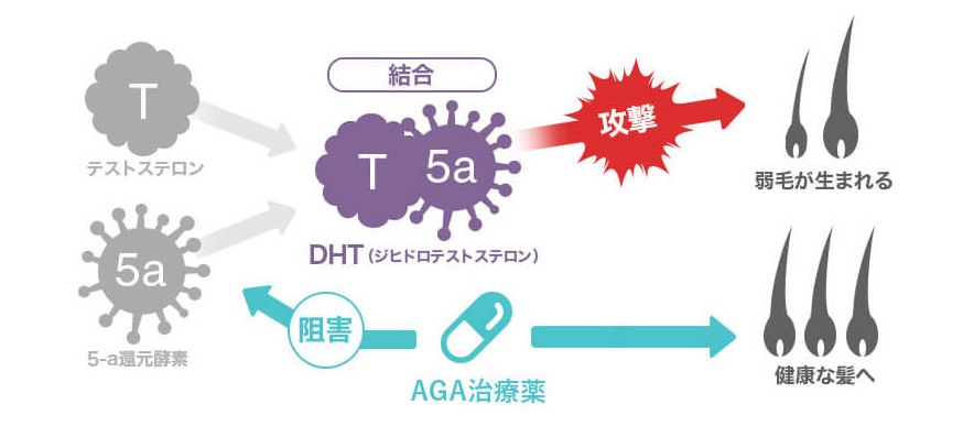 AGA進行の仕組みとAGA治療の効果 図